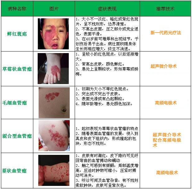 血管瘤医治方法大全