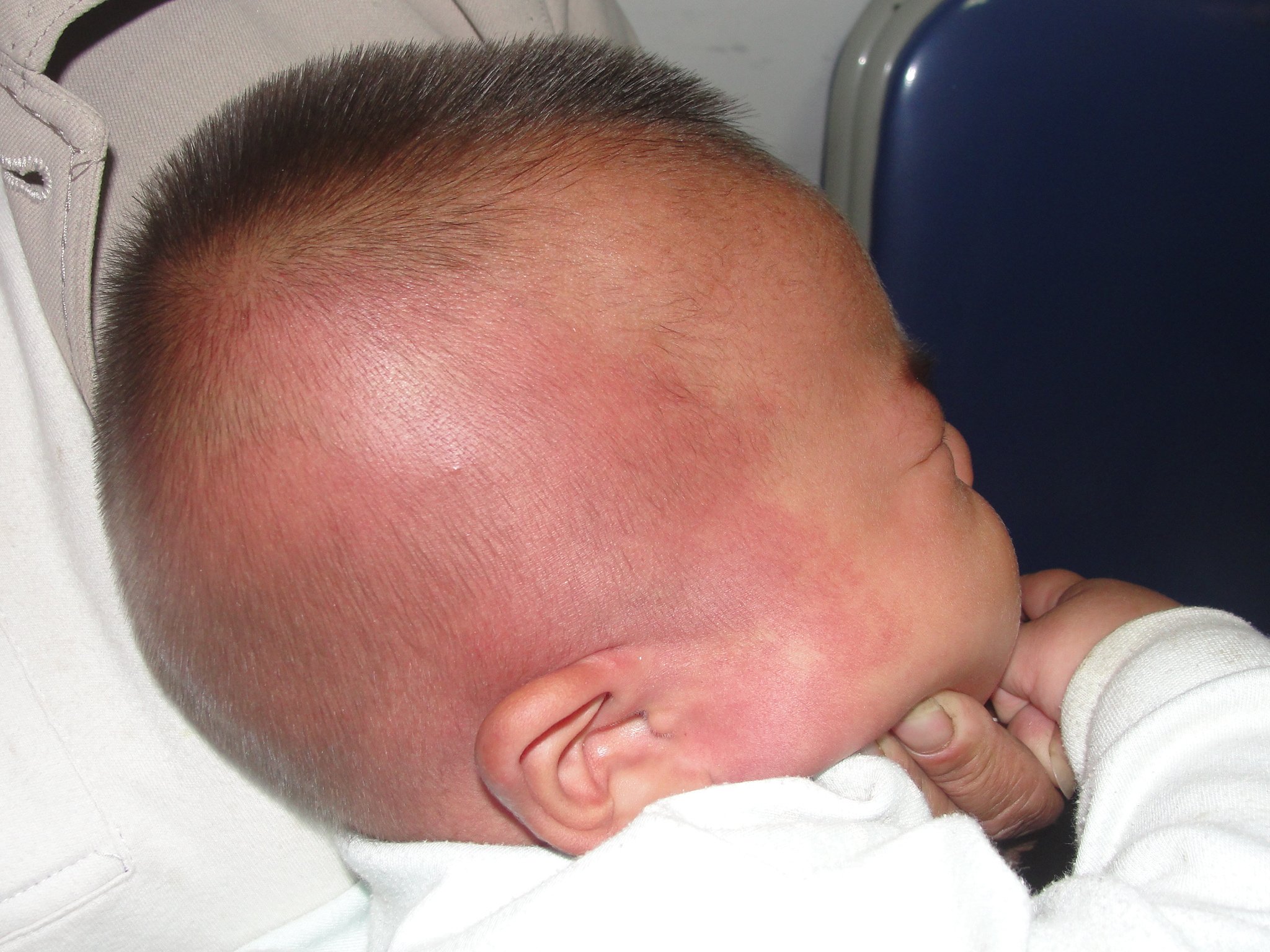 婴儿头顶有条骨缝图片（囟门是宝宝健康）-幼儿百科-魔术铺