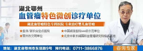 鄂州血管瘤专科医院